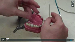 Dental Warrior ET Flex Video