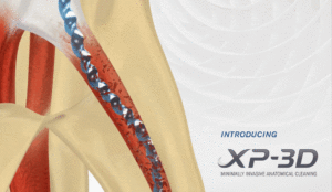 XP-3D Introduction by Brasseler USA