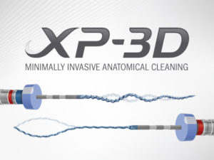 XP-3D, Minimally Invasive Anatomical Cleaning from Brasseler USA