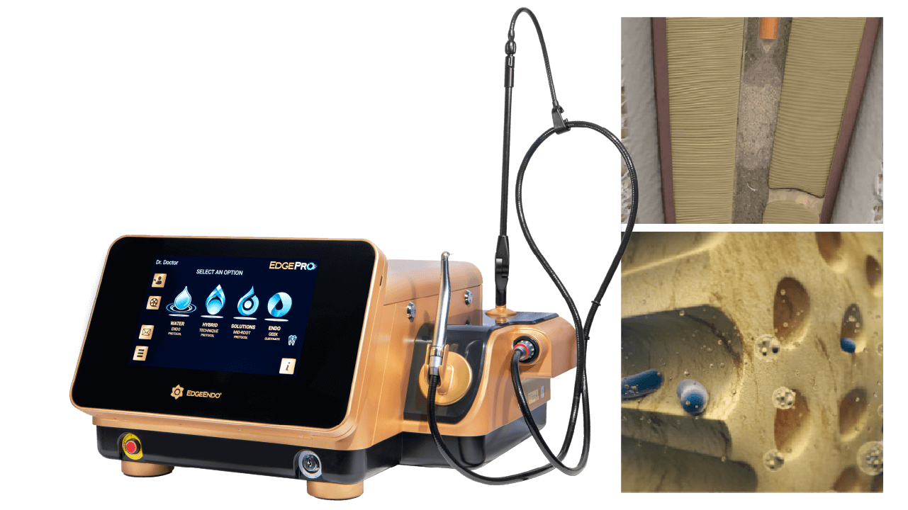 WB-EdgePro-Research@2x Image of the EdgePro Laser and clinical images
