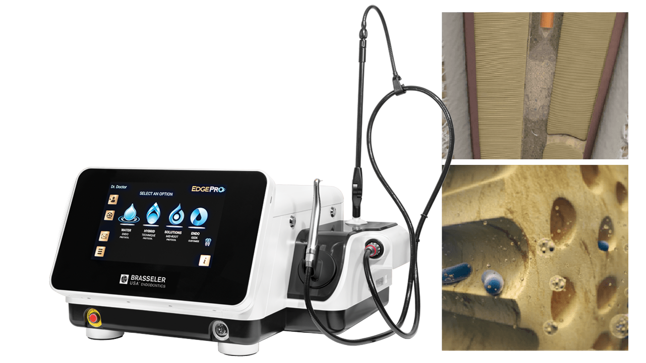 Image of the EdgePro Laser and clinical images